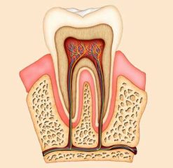 root-canal root-canal